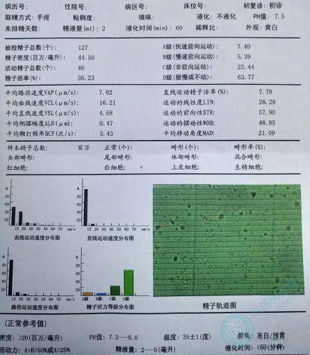 试管婴儿、男性检查、生殖健康、精子质量
