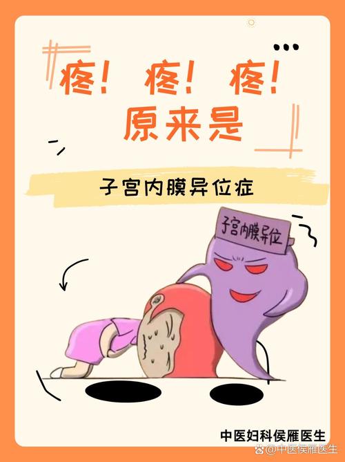卵巢疼痛