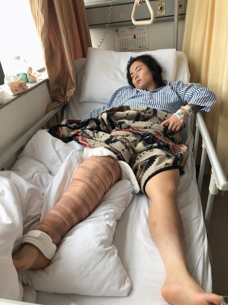 手术后