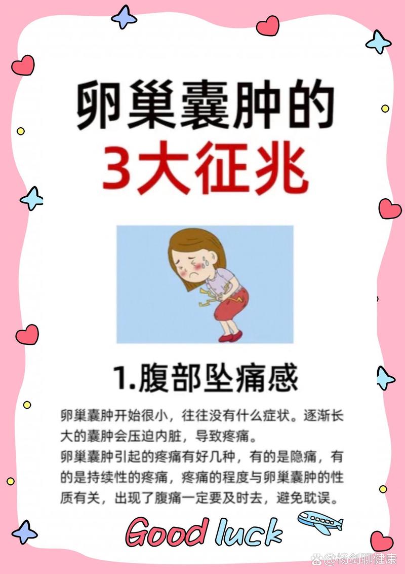 卵巢囊肿