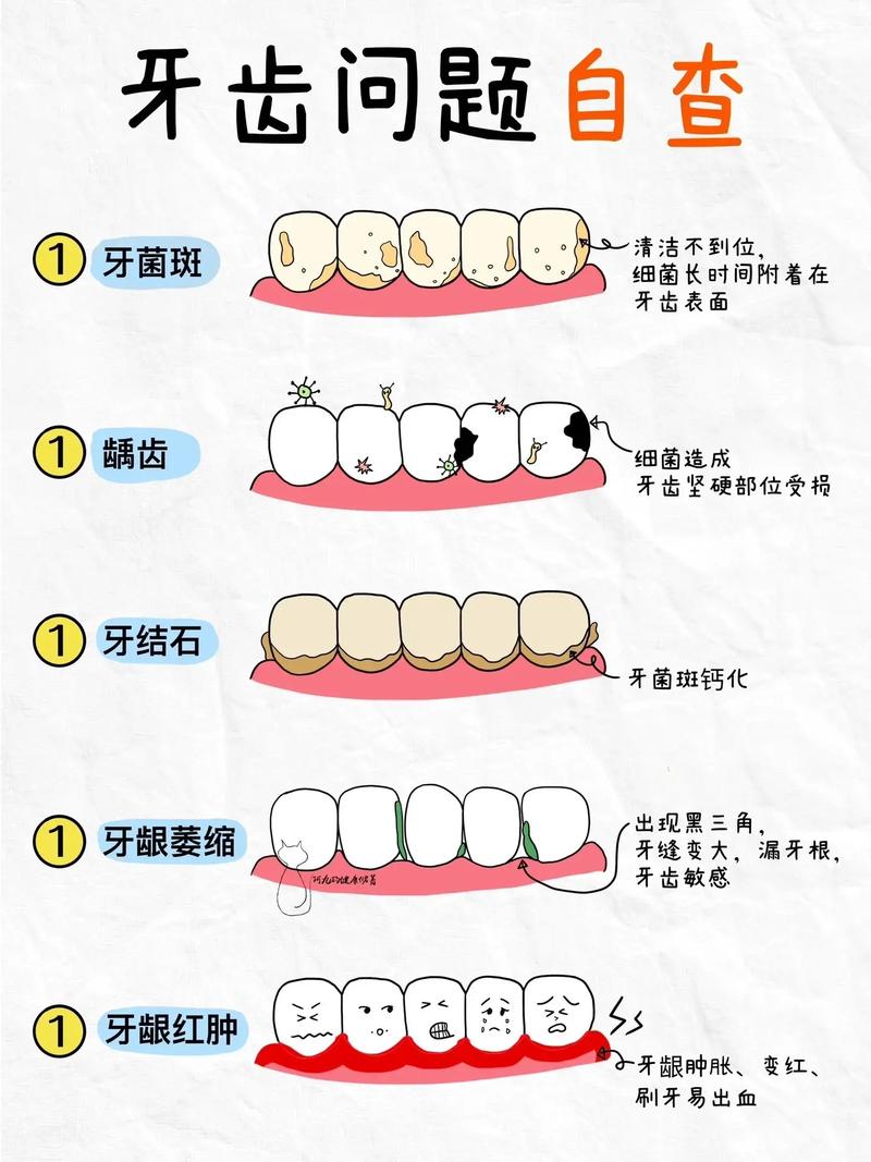 口腔问题