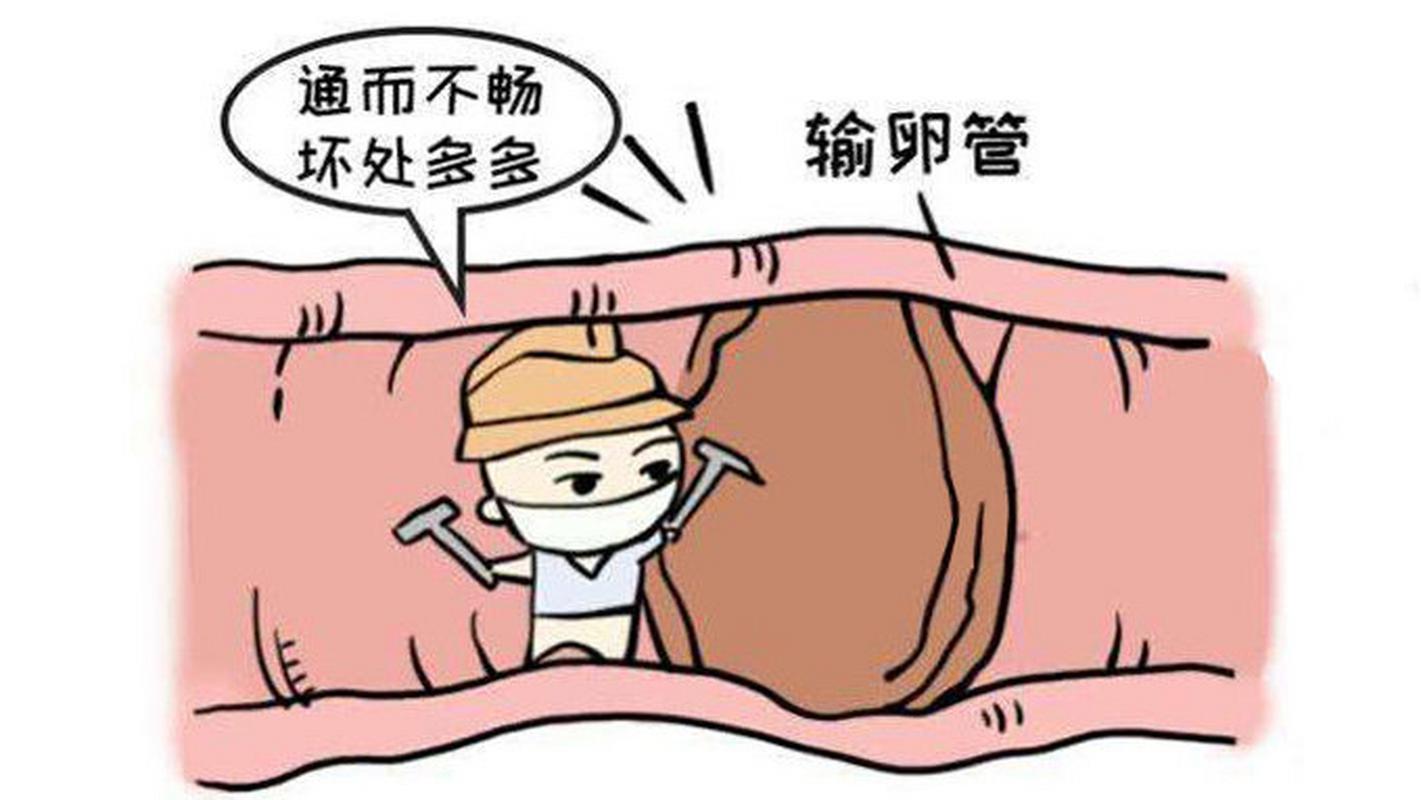 输卵管阻塞