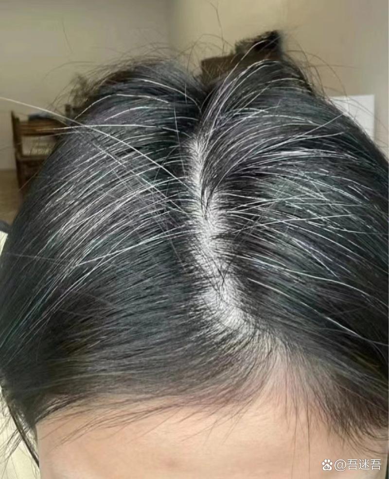 长白发