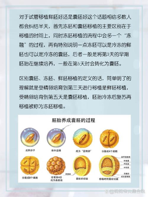 试管婴儿、胚胎保存、移植时间、生殖医学