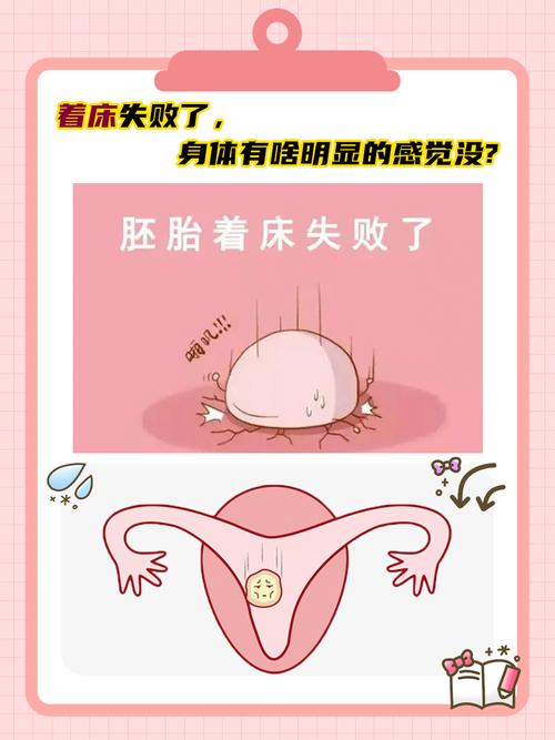  着床失败