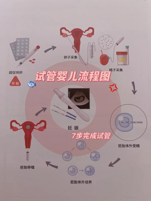 试管婴儿服务确定方法