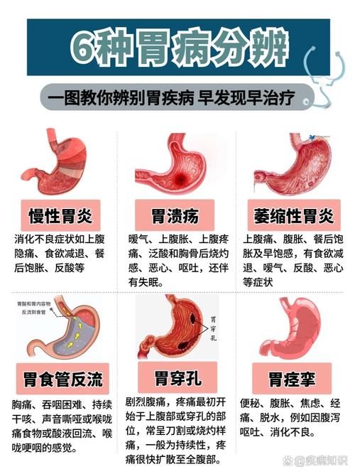 胃部疾病