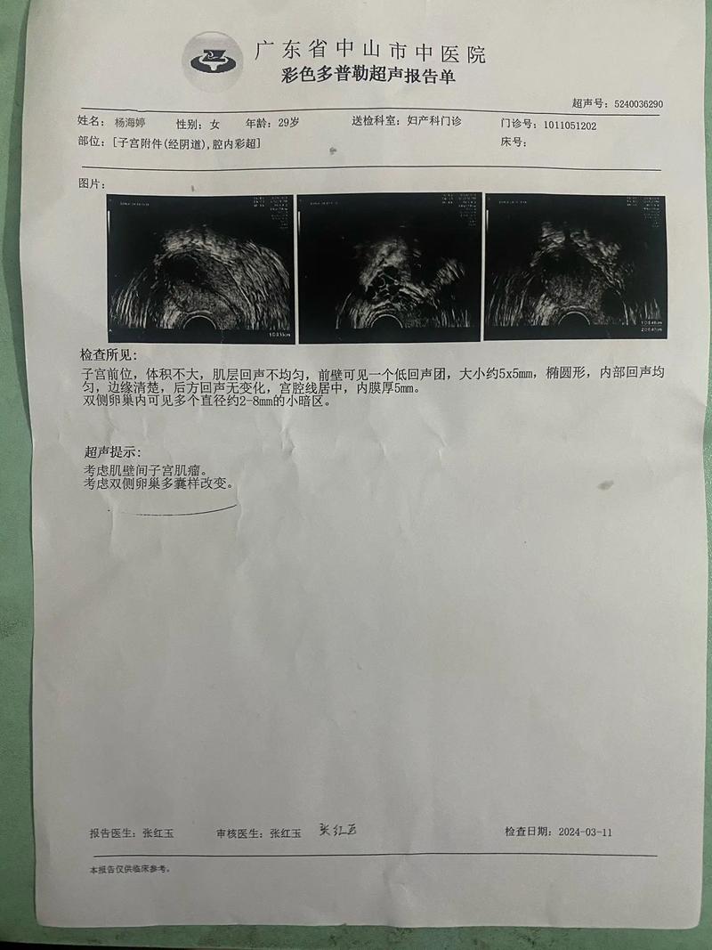 卵巢检查