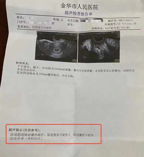  B超检查