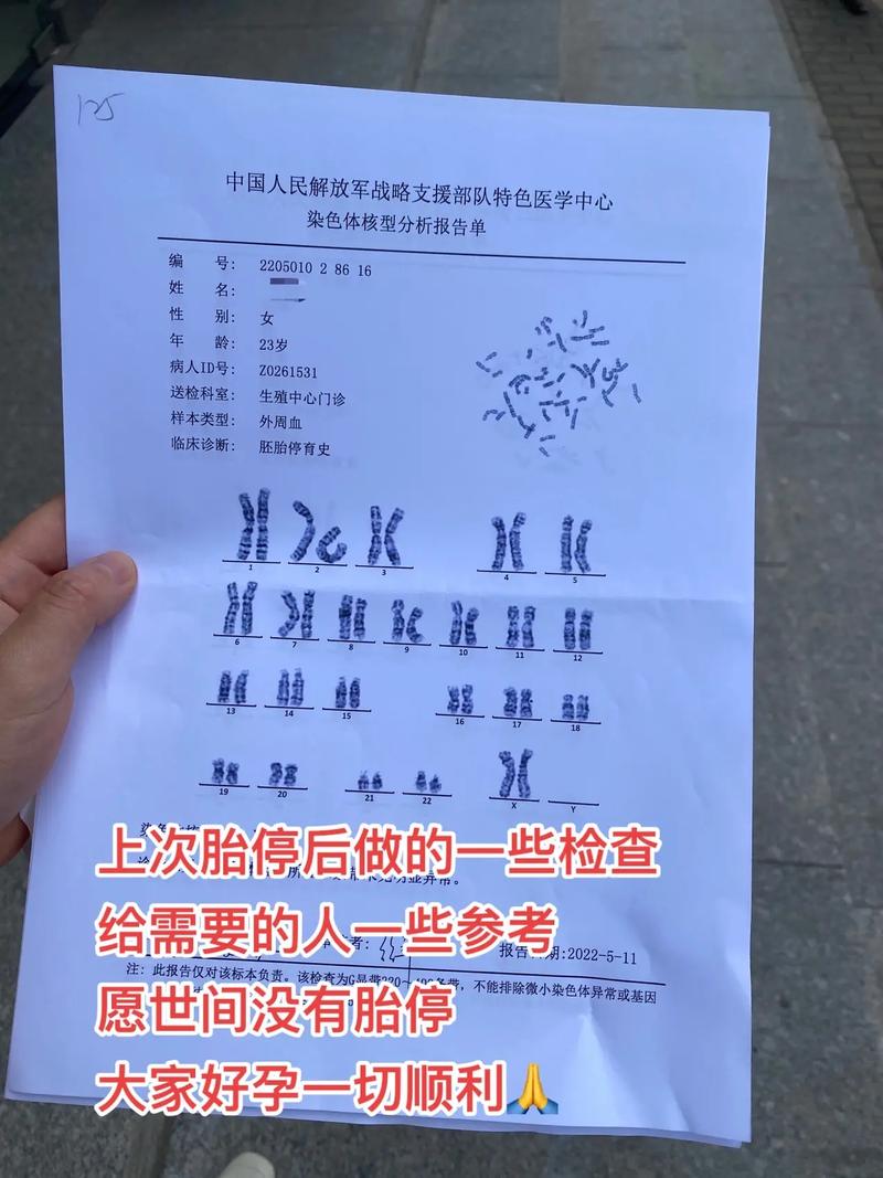 染色体筛查