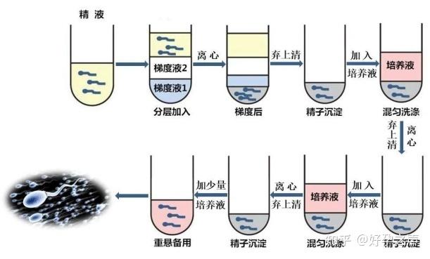 试管婴儿取精量