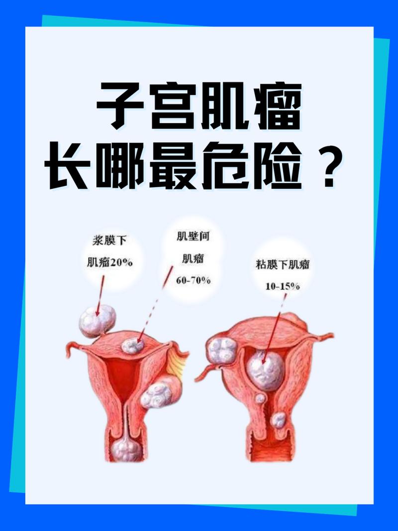 肿瘤风险