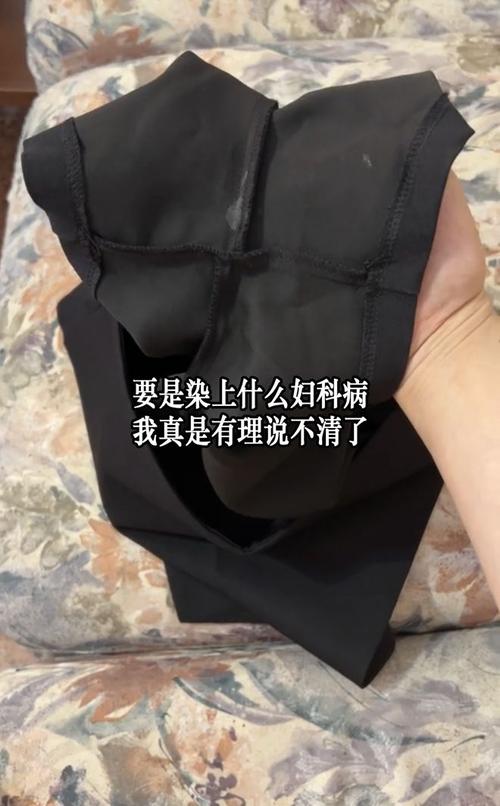 黑色分泌物