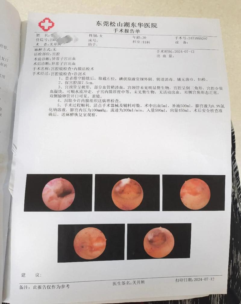 宫腔检查