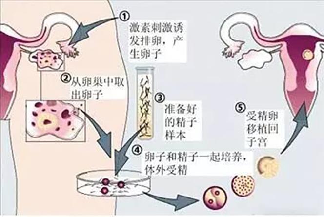 融卵后流程