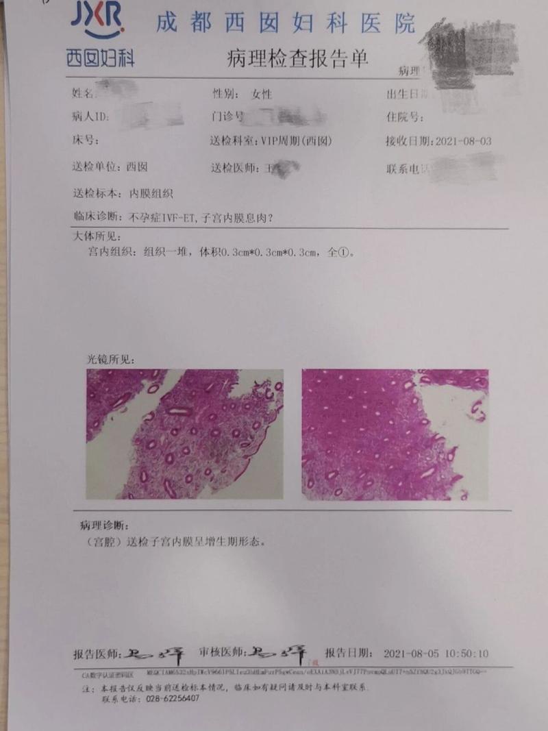 子宫内膜检查