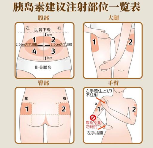  腹部皮下注射