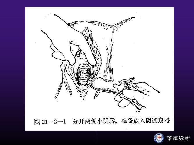 生殖医学检查