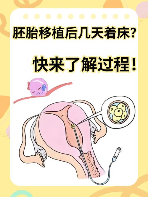 <胚胎移植>