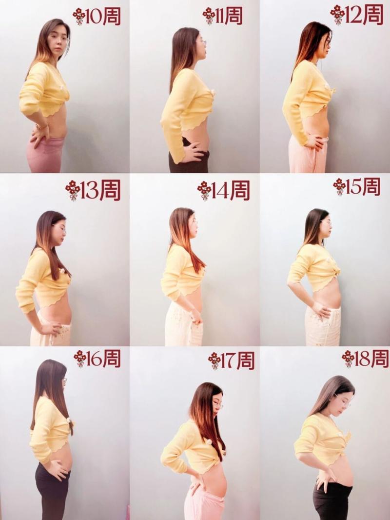 怀孕10周