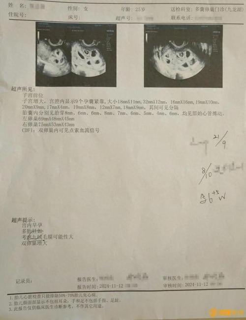 保胎失败