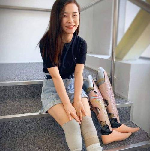 双腿截肢
