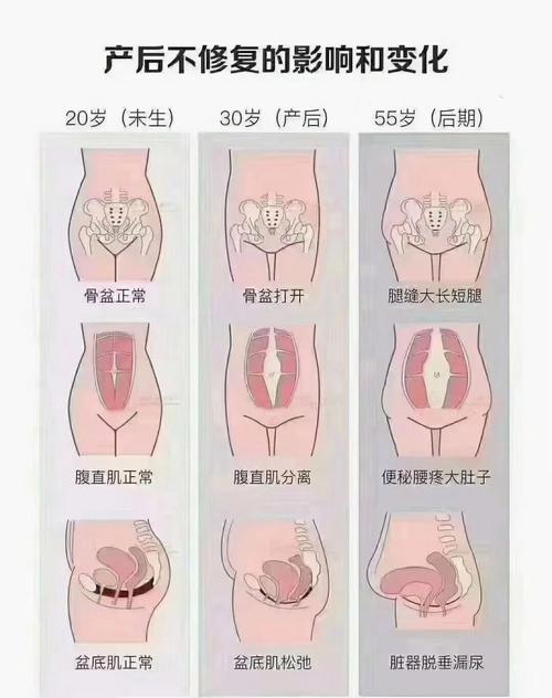  顺产几率
