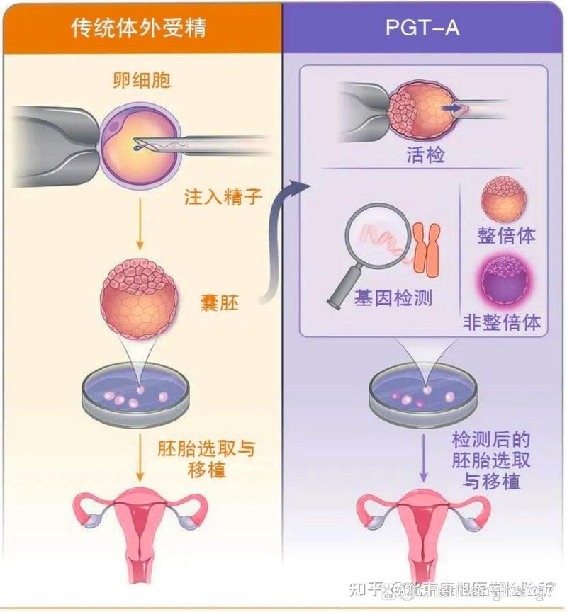  第三代试管婴儿