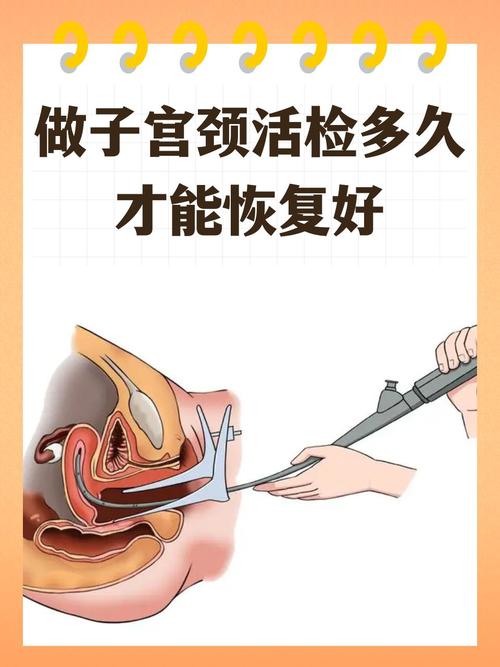 子宫保健