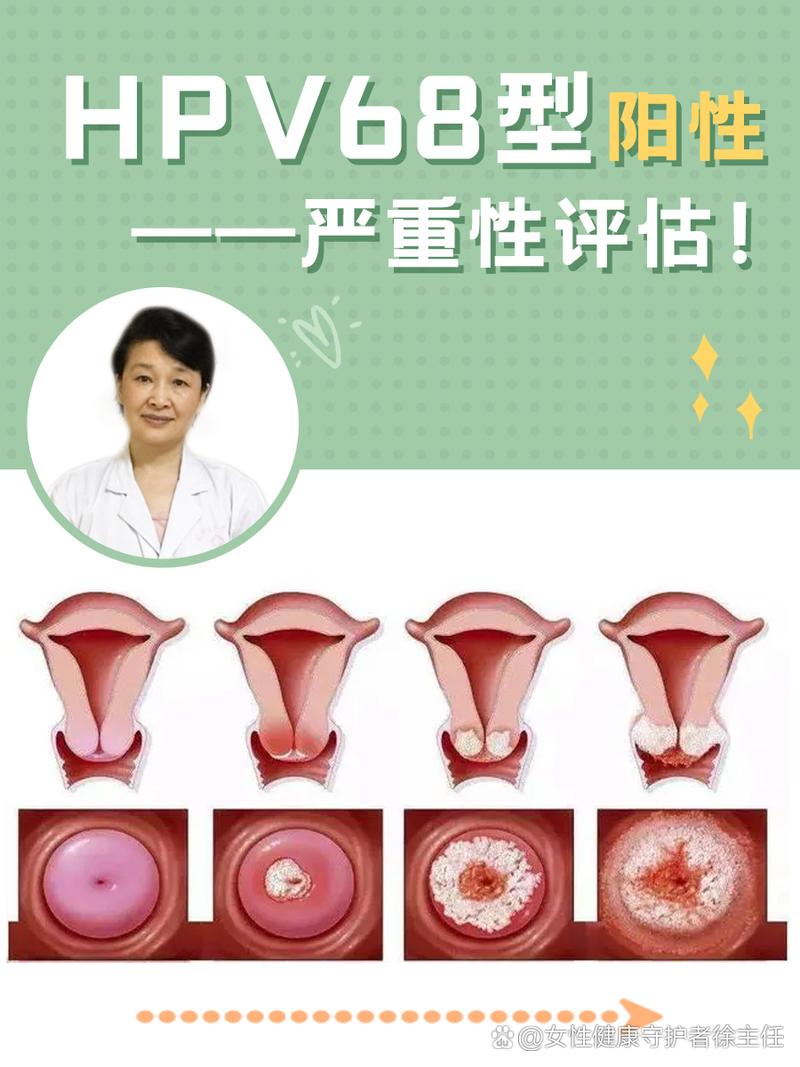 严重性
