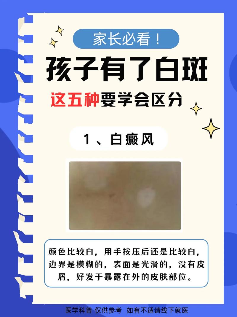 白点图片解析