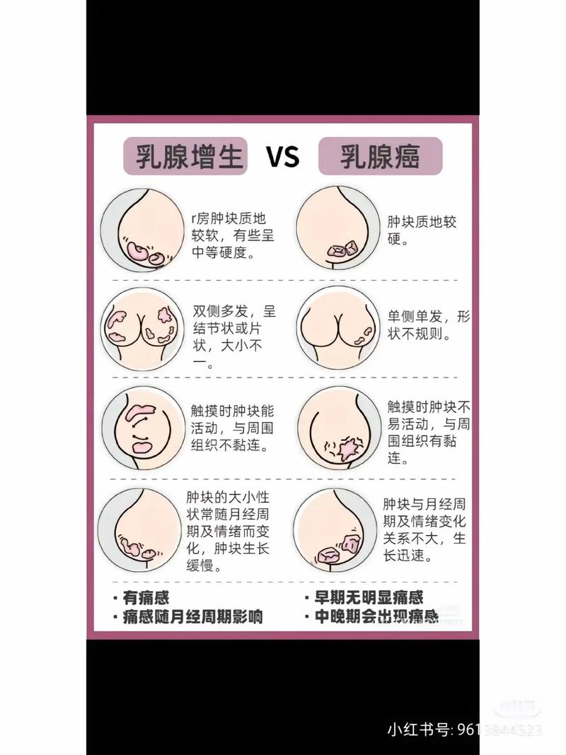乳腺健康