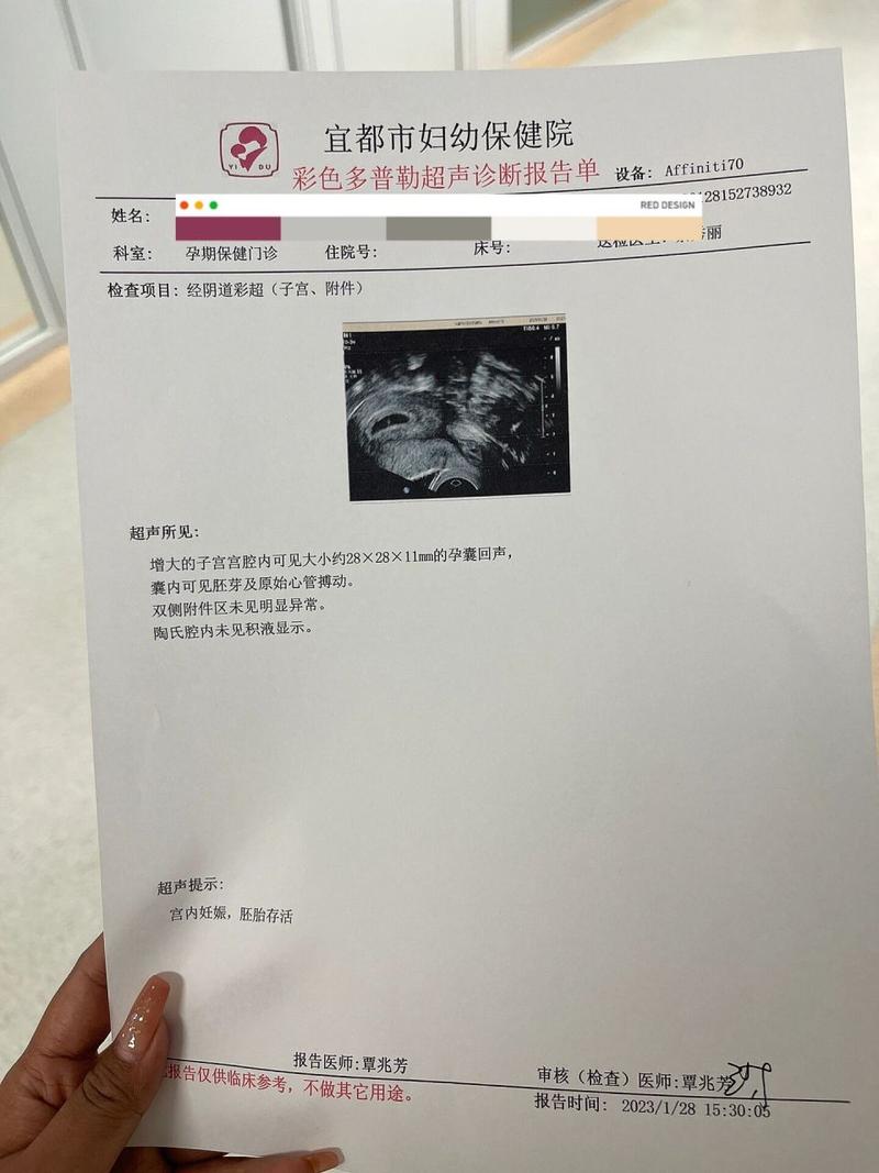 怀孕6周
