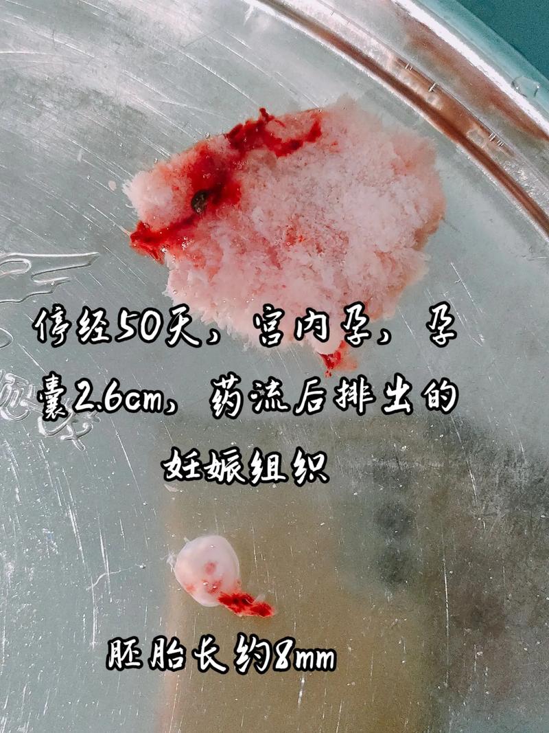 胚胎权益