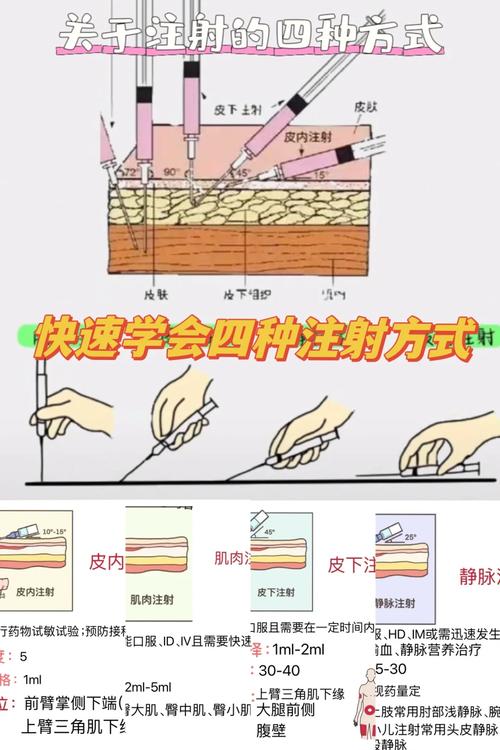 宫颈注射针法