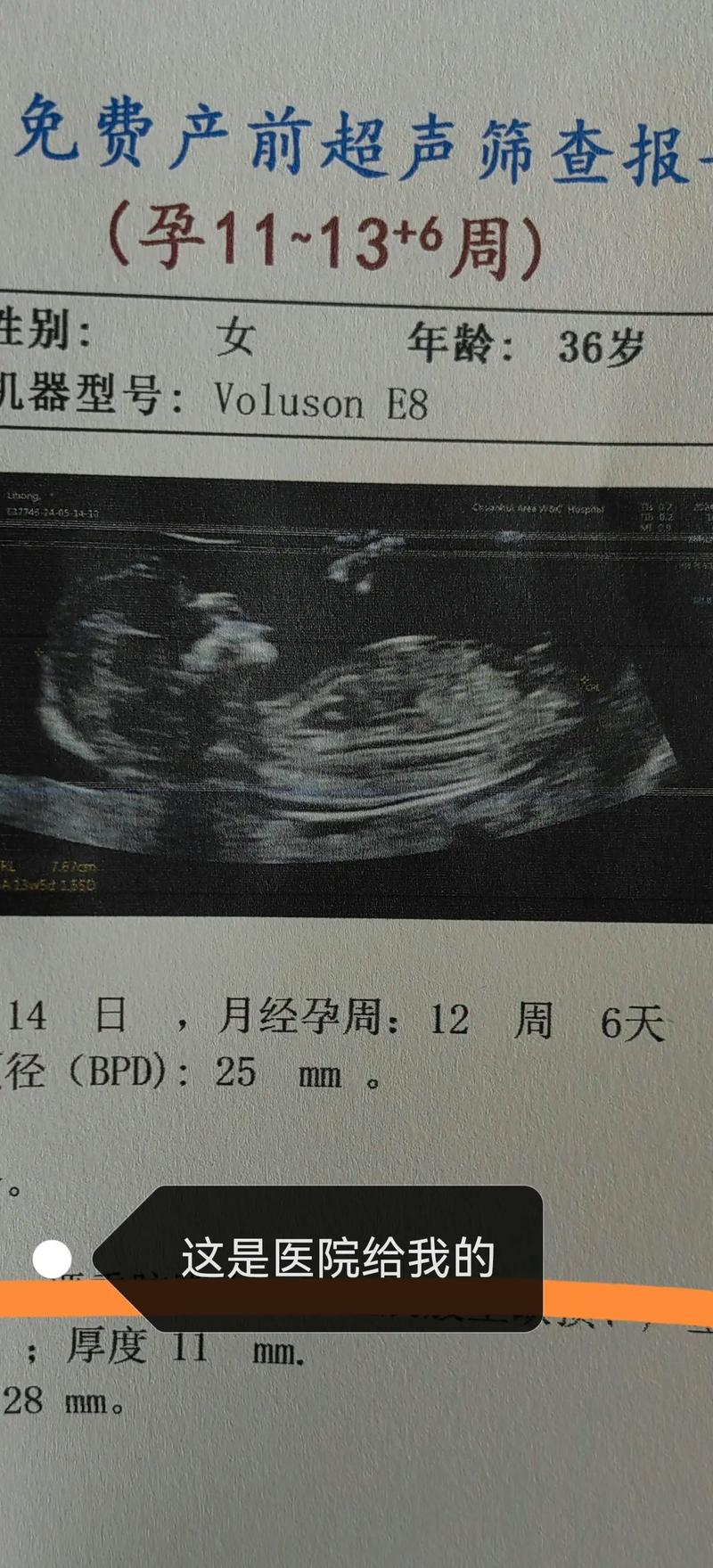 12周胎儿发育