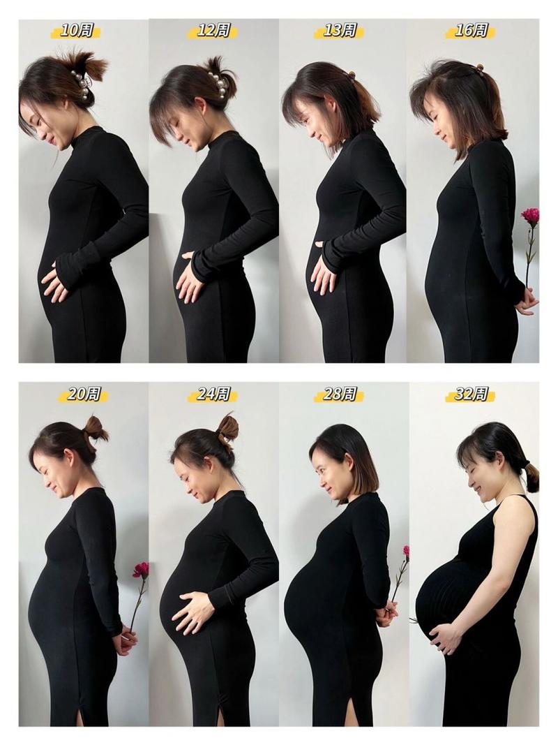 双胎孕妇