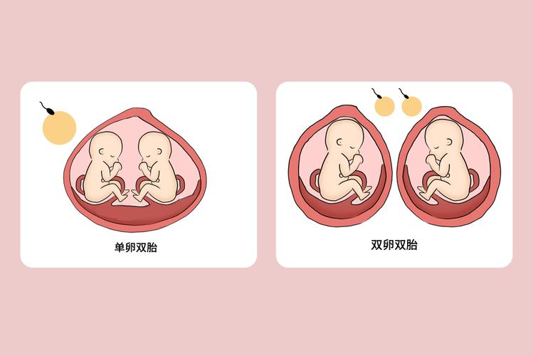  双卵