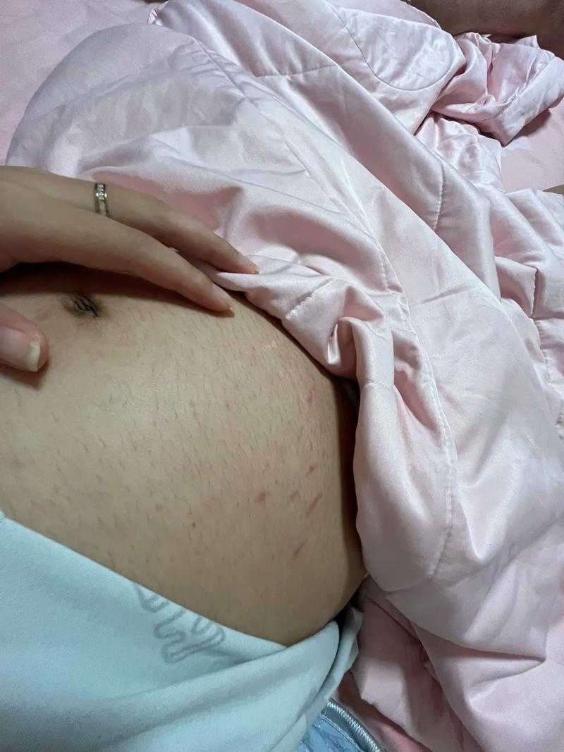 妊娠初期