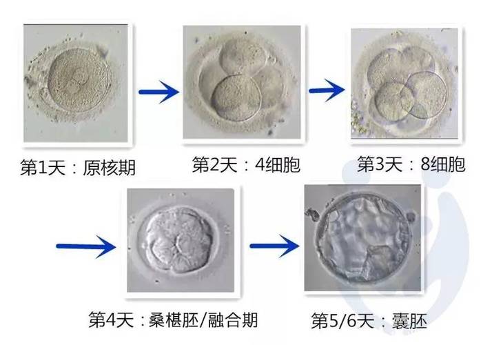 卵子培养