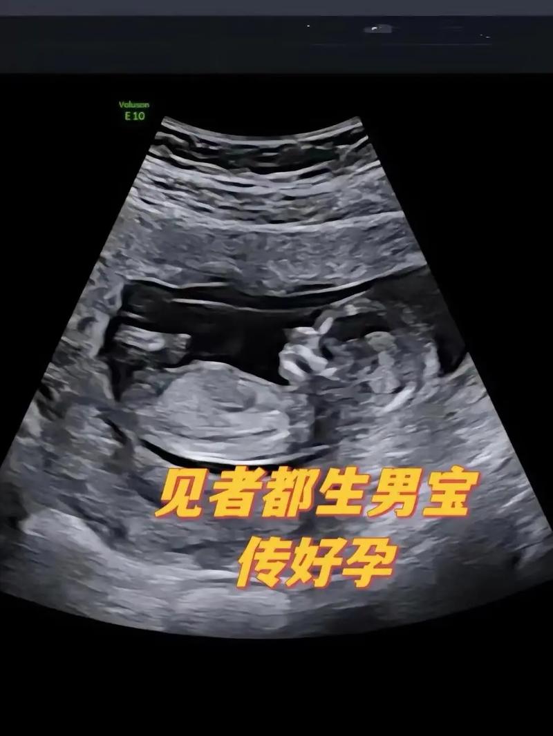 男胚胎