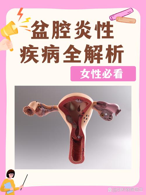 生殖系统炎症