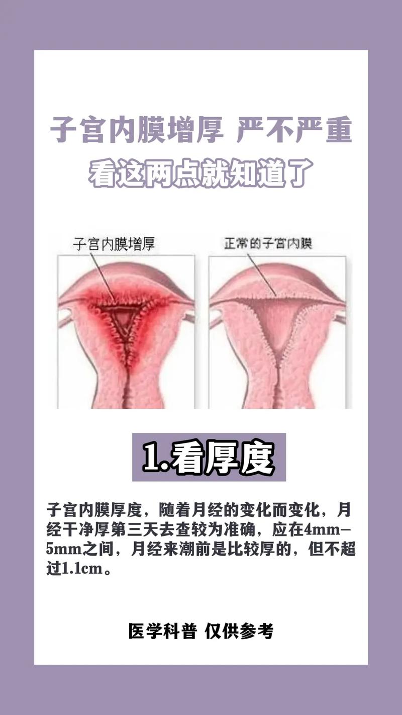 子宫内膜7级