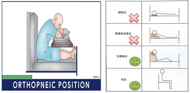  姿势管理