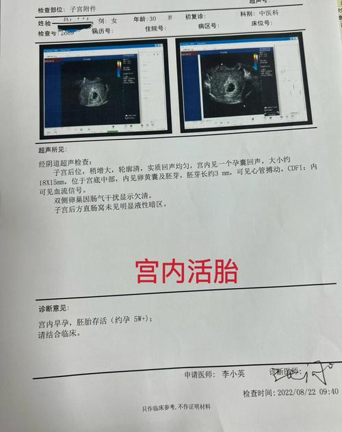  妊娠成功