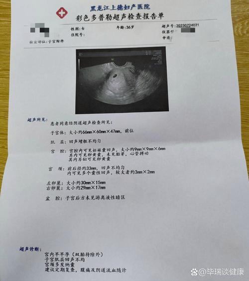 移植后16天