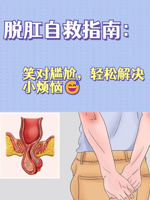 脱肛
