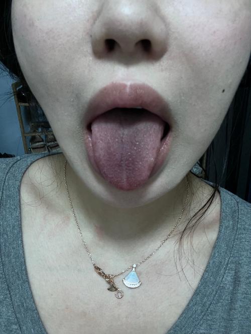 舌苔发黑