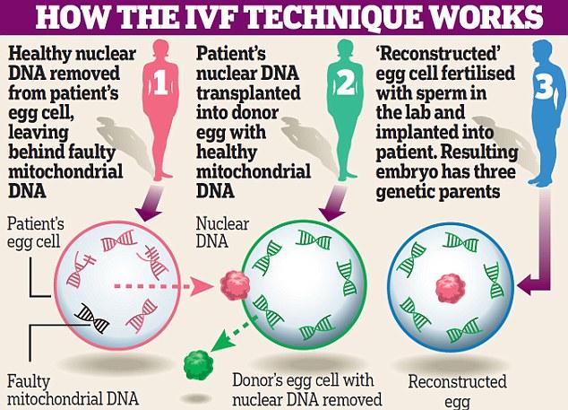 in vitro fertilization