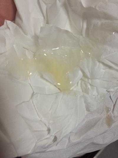 精液质量